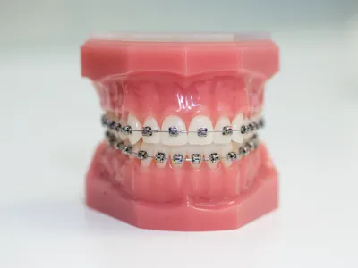 矯正歯科のイメージ